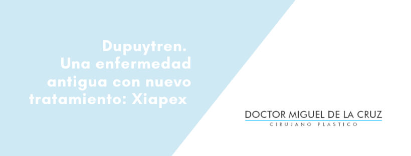 Dupuytren. Una enfermedad antigua con nuevo tratamiento Xiapex