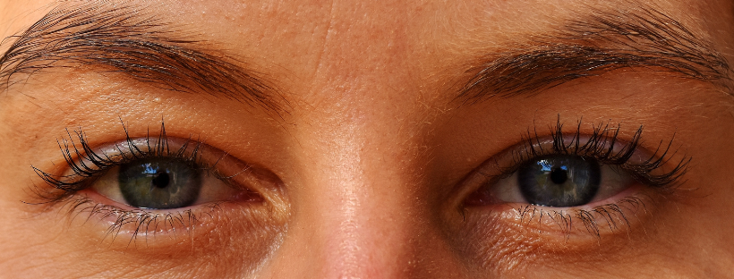 blefaroplastia jerez de la frontera